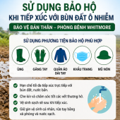 Khuyến cáo người dân và cán bộ, chiến sỹ trong Công an thành phố tăng cường các biện pháp phòng, chống bệnh Whitmore